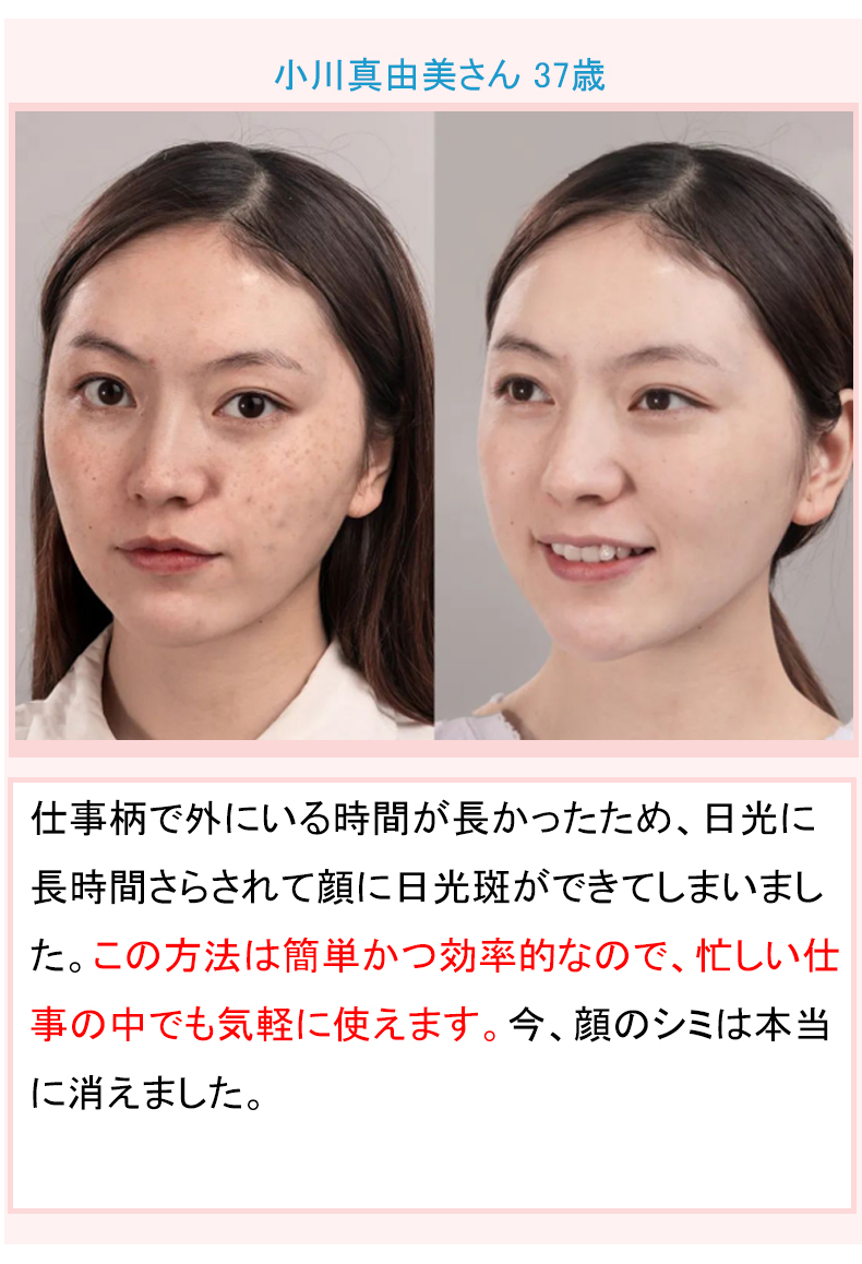 肌のシミのチェックをする女性のイメージ